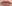 Lip filler (lip augmentation with HA) — Wow Plastic Surgery