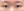 incisional double eyelid surgery — before (7days) · iLumi Plastic Surgery Clinic
