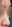 鼻尖形成術（自家軟骨移植） — アン美容外科クリニック