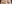二重まぶた（自然癒着法） — プロミス美容外科クリニック