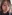 jaw angle reduction (mandibular angle osteotomy) — Eight Plastic Surgery Clinic