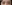 二重まぶた（自然癒着法） — ジャスト美容外科クリニック