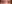 二重まぶた（自然癒着法） — プロミス美容外科クリニック