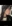 鼻尖形成術（自家軟骨移植） — ヒューマン美容外科