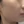 รีจูราน (Rejuran) — ก่อนทำ · คลินิกโมจิ