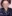 頬骨縮小術（頬骨弓・外側） — UVOM美容外科