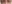 顔全体の脂肪注入（フルフェイス脂肪移植） — スノークリニック