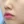 Chemical peel — after (28days) · J.Fill Clinic - Gangnam Branch