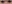 涙袋形成（脂肪注入） — ファクト美容外科クリニック