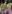 Full-face fat grafting (autologous fat transfer) — Mind Plastic Surgery