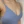 乳房固定術（バストリフト） — 術前 (30日) · マーブル美容外科クリニック