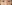 Lower Eyelid Fat Repositioning (transconjunctival) — Wivers Plastic Surgery Clinic