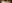 額縮小術（生え際下げ・ヘアライン下降術） — ザフィックス美容外科クリニック