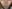 エラボトックス — ヒート美容外科クリニック