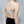 Brachioplasty (arm lift) — before (30days) · The Line Plastic Surgery