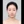 ผ่าตัดลดโหนกแก้มแบบเร็ว (ไม่ใส่ตัวยึด) — ก่อนทำ (90วัน) · ดีเอพลาสติกเซอร์เจอรี่