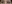 二重まぶた（自然癒着法） — イエロー美容外科クリニック