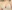 豊胸術（シリコンインプラント／人工乳腺） — アモラタ美容外科クリニック