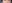 裏ハムラ法（経結膜的眼窩脂肪移動術） — エイペックス美容外科クリニック