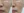 皮下分离术（Subcision，痘坑松解） — 术后 (30天) · The Ollim医美诊所