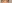 裏ハムラ法（経結膜的眼窩脂肪移動術） — プレジャー美容外科クリニック