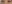 裏ハムラ法（経結膜的眼窩脂肪移動術） — オブジェ美容外科クリニック