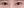 ผ่าตัดแก้ขนตาทิ่มตา (ขนตาแยงตา / เปลือกตาม้วนเข้า) — ก่อนทำ (60วัน) · ชาอีศัลยกรรม