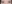 二重まぶた（自然癒着法） — イーエス清潭美容外科クリニック