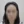 Scalp hair transplant — after (10days) · Vance Mosae Clinic