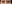 二重まぶた（自然癒着法） — エイペックス美容外科クリニック