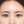 ลบรอยสักคิ้ว (ลบคิ้วกึ่งถาวร) — ก่อนทำ (7วัน) · คลินิก Apgujeong Beauty & Me