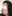 Bulbous nose correction (surgical nasal tip reduction) — Coco Line Clinic