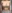 豊胸術（シリコンインプラント／人工乳腺） — バナナ美容外科クリニック