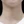 Neck wrinkle Botox (platysma band Botox / Nefertiti lift) — after (30days) · A-Top Plastic Surgery Clinic