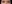 裏ハムラ法（経結膜的眼窩脂肪移動術） — アーバン美容外科クリニック