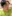 Revision facial contouring surgery (secondary facial bone surgery) — WHY Oral and Maxillofacial Surgery & Dental Clinic
