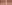 裏ハムラ法（経結膜的眼窩脂肪移動術） — ファクト美容外科クリニック