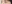裏ハムラ法（経結膜的眼窩脂肪移動術） — IK美容外科クリニック