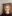 Facelift (rhytidectomy) — Uri Plastic Surgery Clinic