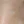 acne scar subcision / regenerative needling — before (40days) · Rodam Korean Medicine Clinic - Gangnam Branch