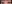 切開法（全切開法二重術） — エイペックス美容外科クリニック