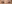 二重まぶた（自然癒着法） — アウラ美容外科クリニック