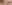スキンボトックス（マイクロボトックス） — ジウクリニック