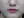 Botox for nasolabial folds — before (30days) · K-Tox Clinic - Bupyeong Branch