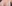 豊胸（脂肪注入） — ソウルアイ美容外科クリニック