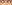 裏ハムラ法（経結膜的眼窩脂肪移動術） — ファクト美容外科クリニック