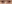 裏ハムラ法（経結膜的眼窩脂肪移動術） — ファクト美容外科クリニック