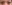 二重まぶた（自然癒着法） — プロミス美容外科クリニック