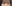 裏ハムラ法（経結膜的眼窩脂肪移動術） — プレジャー美容外科クリニック
