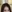 額縮小術（生え際下げ・ヘアライン下降術） — コウユ美容外科クリニック